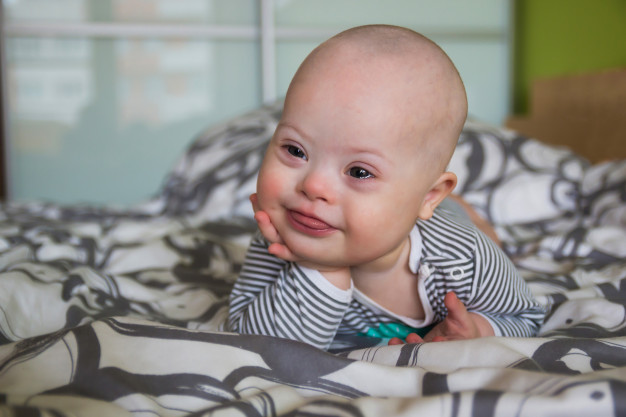 sindrome-de-down-freepik2