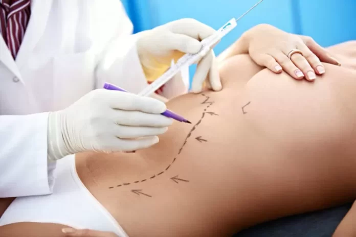 lipoasipiraçao2